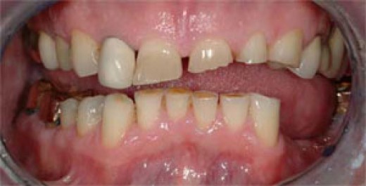 What Is Dog Bruxism?